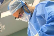 عمل بینی فانتزی یا طبیعی؟ بهترین جراح بینی در تهران: دکتر مفرد