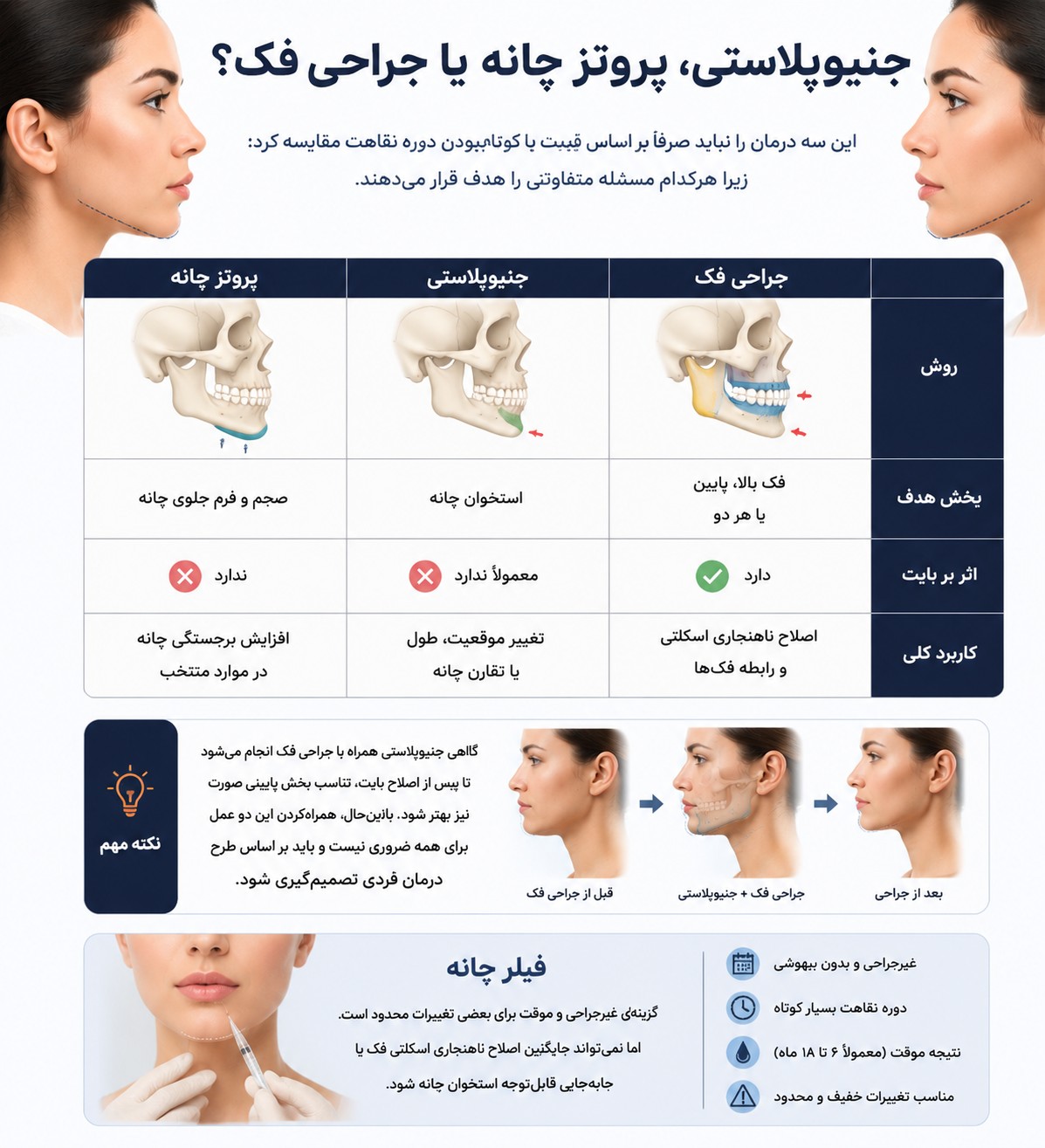 جنیوپلاستی، پروتز چانه یا جراحی فک